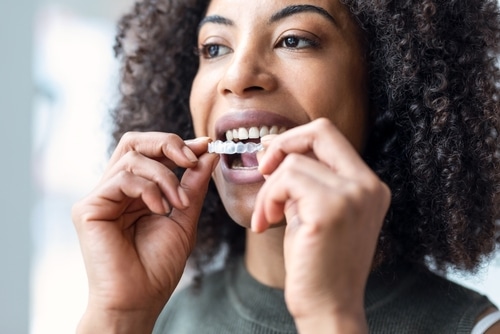 Invisalign in Winston-Salem, NC | Discreet Braces Alternatives
