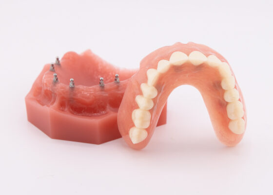 Snap-In Dentures in Winston-Salem, NC | Secure Your Smile Today