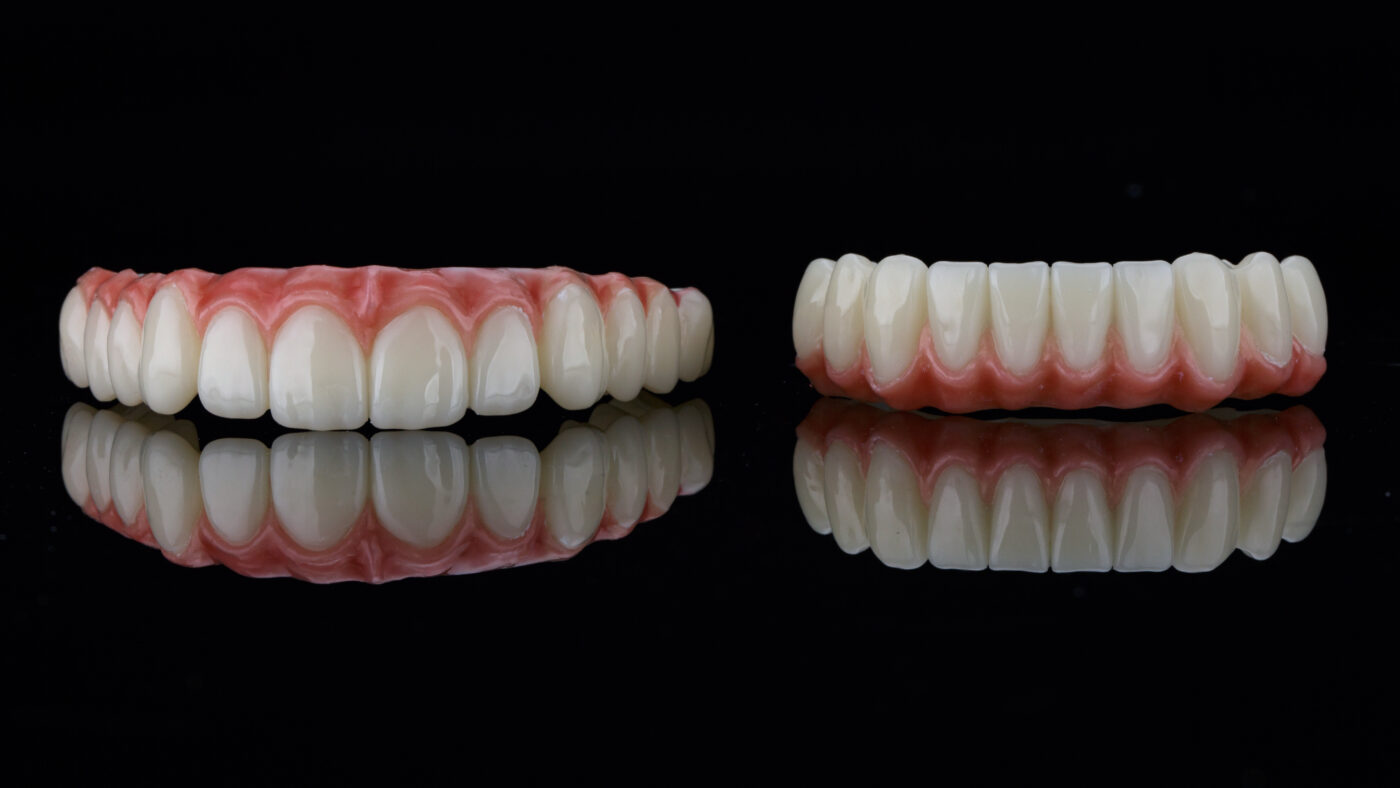 Permanent Dentures in Winston-Salem, NC | Affordable Implants