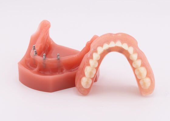 Permanent Dentures in Winston-Salem, NC | Affordable Snap-In Dentures | Mini Implants