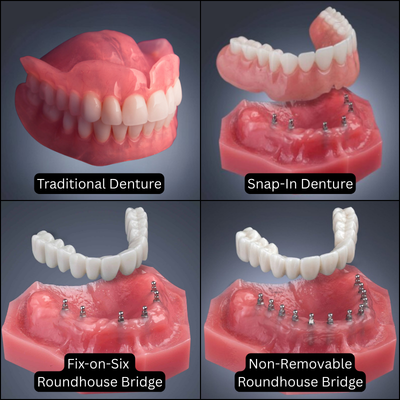 Denture Center in Winston-Salem, NC [Video Explainer]