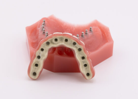 Denture Options in Winston-Salem | Implant Consults [Video Guide]