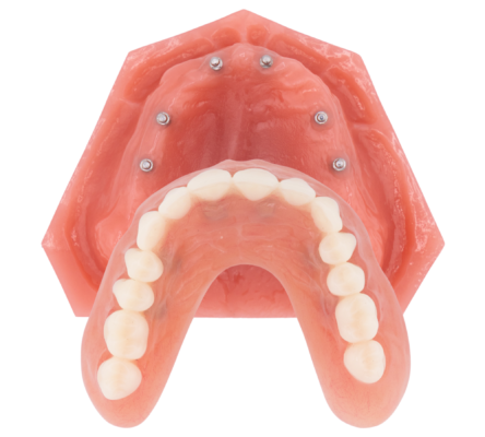 Affordable Dentures in Winston-Salem, NC [Video Q&A]