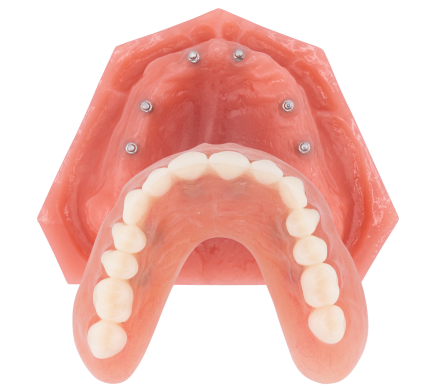 Affordable Dentures in Winston-Salem, NC [Video Q&A]