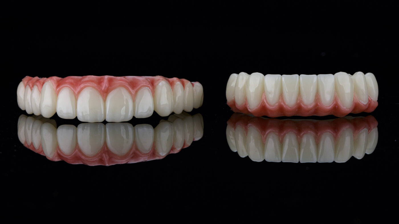 All-on-4 in Winston-Salem, NC | Mini Implant Dentures [Video Q&A]