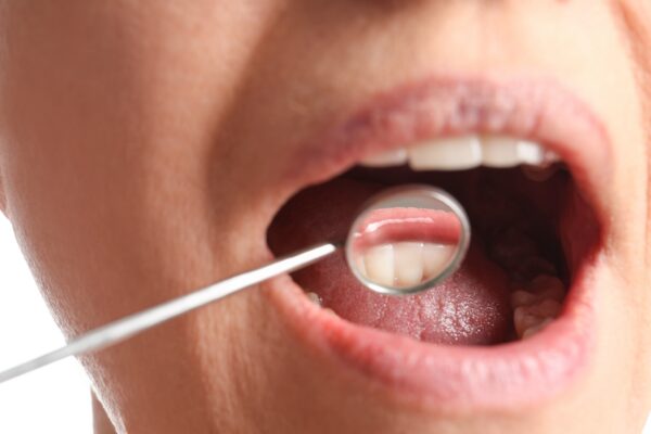 Oral Cancer Screening in Winston-Salem, NC [Video Explainer]