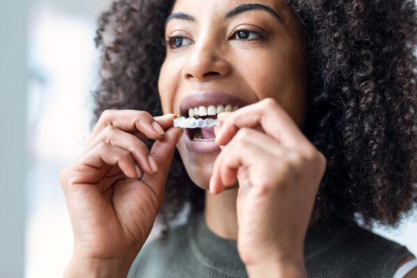Clear Aligners in Winston-Salem, NC | Discreet Braces Alternatives