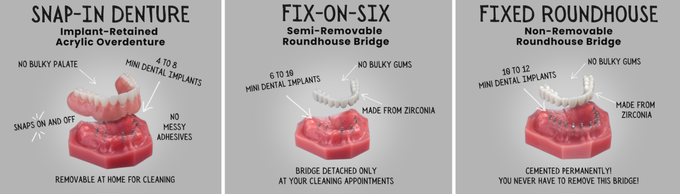 Denture Alternatives in Winston-Salem, NC | Affordable Consults